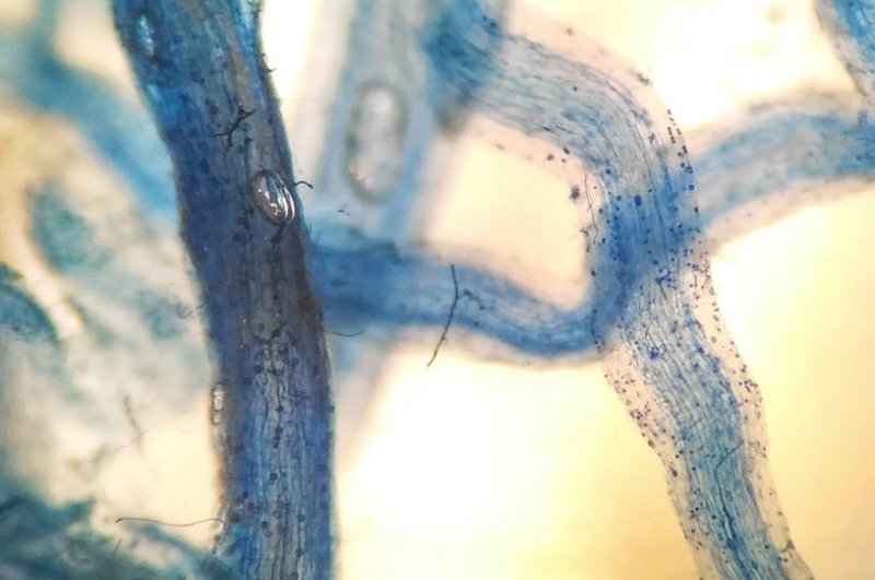 Évaluer la colonisation des mycorhizes dans les racines des plantes